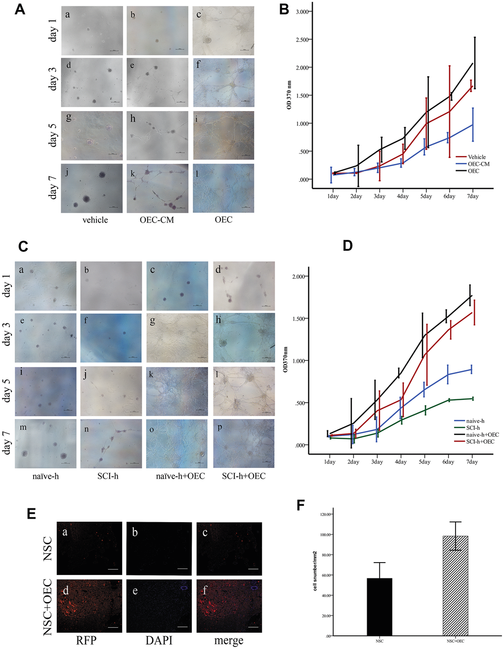 OECs promote NSC survival in the SCI microenvironment. (A) In vitro, the morphologies of the cells were observed under an inverted microscope. Scale bar: 100 μm; (B) The proliferation rates of NSCs assessed via MTT assays (mean ± SEM; two-way ANOVA, error bar: 95% CI). (C) Effects of OECs on NSC proliferation under SCI conditions observed under an inverted microscope. Scale bar: 100 μm; (D) The proliferation rates of NSCs assessed via MTT assays (mean ± SEM; two-way ANOVA, error bar: 95% CI). (E) In vivo, the survival of NSCs in different groups: (A–C) NSC transplantation alone, where RFP-positive cells were NSCs. Scale bar: 100 μm. (D–F) Transplantation of NSCs and OECs. Scale bar: 100 μm. (F) Quantification of the survival of RFP+ cells at two weeks after transplantation (means ± SEM, n=6; P