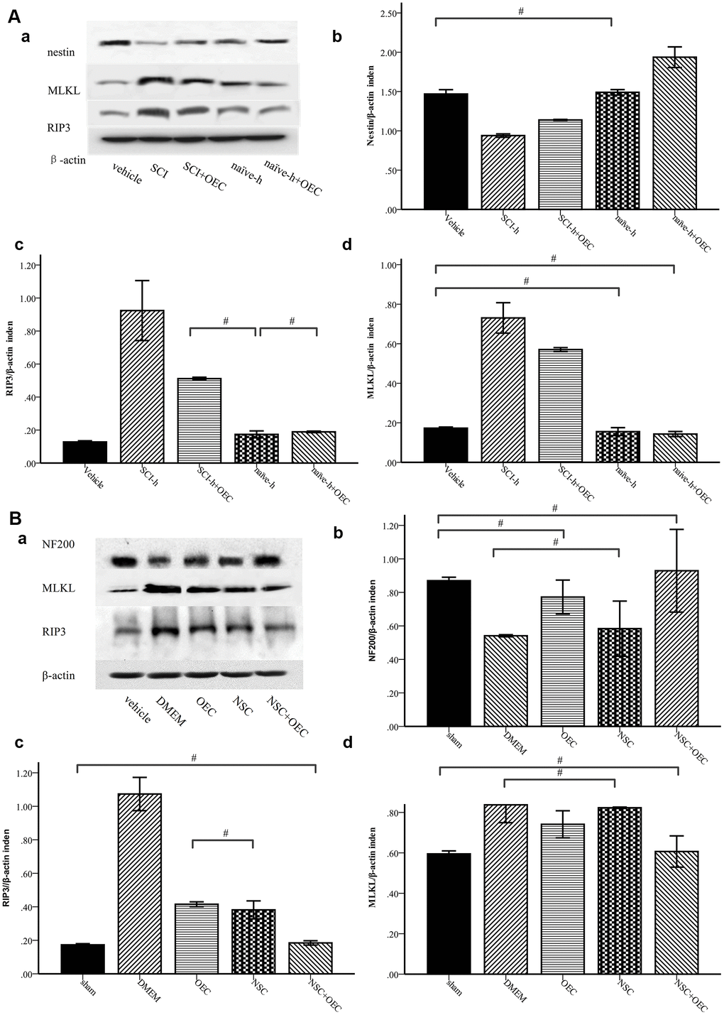 Western-blot analysis reveals that OECs downregulate the expression of RIP3 and MLKL and inhibit SCI-induced increases of RIP3 and MLKL. (A) In-vitro Western-blotting analysis showed that SCI induced upregulated expression of RIP3 and MLKL, and that OECs counteracted these changes to protect NSCs. (a) The protein expression level evaluated via Western blotting. (b–d) Data presented are expressed as the mean ± SEM (n = 6; one-way ANOVA, post-hoc test: Dunn-Bonferroni; error bar: 95% CI; #P>0.05 and except for # in the figure; P values were all less than 0.05). (B) Two weeks after transplantation, protein levels of NF200, RIP3, and MLKL showed that OECs suppressed RIP3/MLKL-mediated necroptosis and protected NSCs. (a) The expression levels of NF200, RIP3, and MLKL were detected by Western blotting. (b–d) Data presented are expressed as the mean ± SEM (n = 6; one-way ANOVA, post-hoc test: Dunn-Bonferroni; error bar: 95% CI; #P>0.05, except for the # in the figure; P values were all less than 0.05).