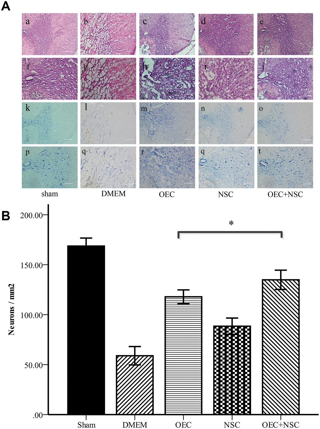 (A) Morphological changes at one week after SCI. (a–j) HE staining in each group. Scale bars: a–c 100 μm, f–j 50 μm. (k–t) Nissl staining in each group. Scale bars: k–o 100 μm, p–t 50 μm; (B) Quantitative analysis showed that the number of neurons in the OEC+NSC group was significantly increased in comparison with that in the DMEM group or NSC group. (mean ± SEM; one-way ANOVA, post-hoc test: Dunn-Bonferroni; error bar: 95% CI; *P