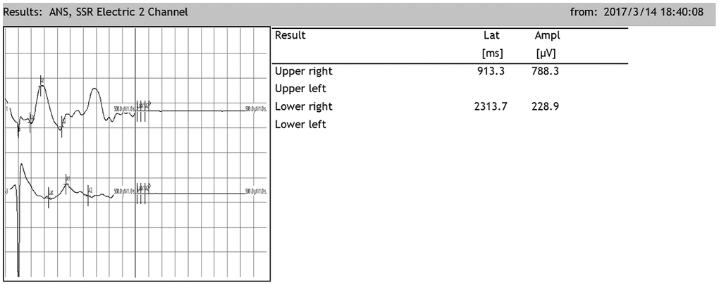 Representative sympathetic skin responses in SCI rats. The median nerve was stimulated at the left wrist, and the recording points were located in the right palm of the forepaw and the right palm of the hindpaw.