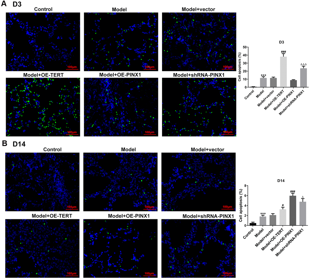 TERT overexpression or PINX1 silencing aggravated apoptosis on D3 while promoted the recovery of apoptosis on D14, whereas PINX1 overexpression presented the opposite effects. Cell apoptosis on (A) D3 and (B) D14 was detected using TUNEL staining. ***P#P###PΔPΔΔΔP