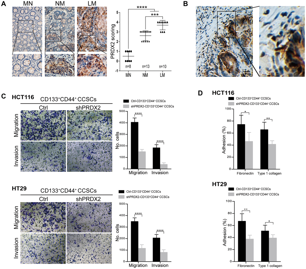 PRDX2 depletion decreases the migration and invasion capacities of CCSCs. (A) Left panel: Representative IHC staining for PRDX2 expression in matched normal (MN) colon tissues, nonmetastatic (NM) colon cancer tissues and colon cancer tissues with live metastasis (LM). The corresponding high-magnification images are also shown. Right panel: The PRDX2 expression intensity scores for 25 patient tissues, including MN (n = 8), NM (n = 13), and LM (n = 10). Statistical analysis: Fisher’s exact test, ***p ***p B) Representative IHC staining for PRDX2 in the invasive front reveals clustering of tumor cells with PRDX2 accumulation. (C) Invasive and migratory capacities of CD133+CD44+ CCSCs generated from HCT116/HT29 control or shPRDX2 cells (left panel). The bars represent the means ± SD of invaded/migrated cells from three independent experiments performed in duplicate (right panel). Statistical analysis: Student’s t-test, ***p ****p D) Adhesive capacity of HCT116/HT29-control- or -shPRDX2- CD133+CD44+ CCSCs to fibronectin and type 1 collagen, respectively. Percent adhesion was calculated as the number of adhesive cells/adhesive cells + nonadhesive cells. The data are presented as the percent of adhesive cells observed in three fields per assay and are expressed as an average of triplicate determinations. Statistical analysis: Student’s t-test, *p **p 