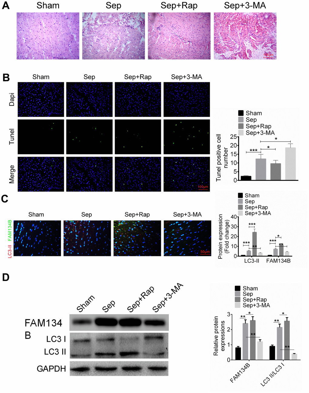 The expression of FAM134B in the mice with sepsis myocardial injury. (A) Mice were divided into four groups: Sham, Sep, Sep + Rap group, and Sep + 3-MA group, and the myocardial histomorphology was examined by H&E staining. (B) Myocardial apoptosis was identified by TUNEL analysis. (C, D) Protein expressions of LC3-II/I (red fluorescence) and FAM134B (green fluorescence) in the myocardial tissues were examined by immunofluorescence and western blot. Data are shown as mean ± SD. *P