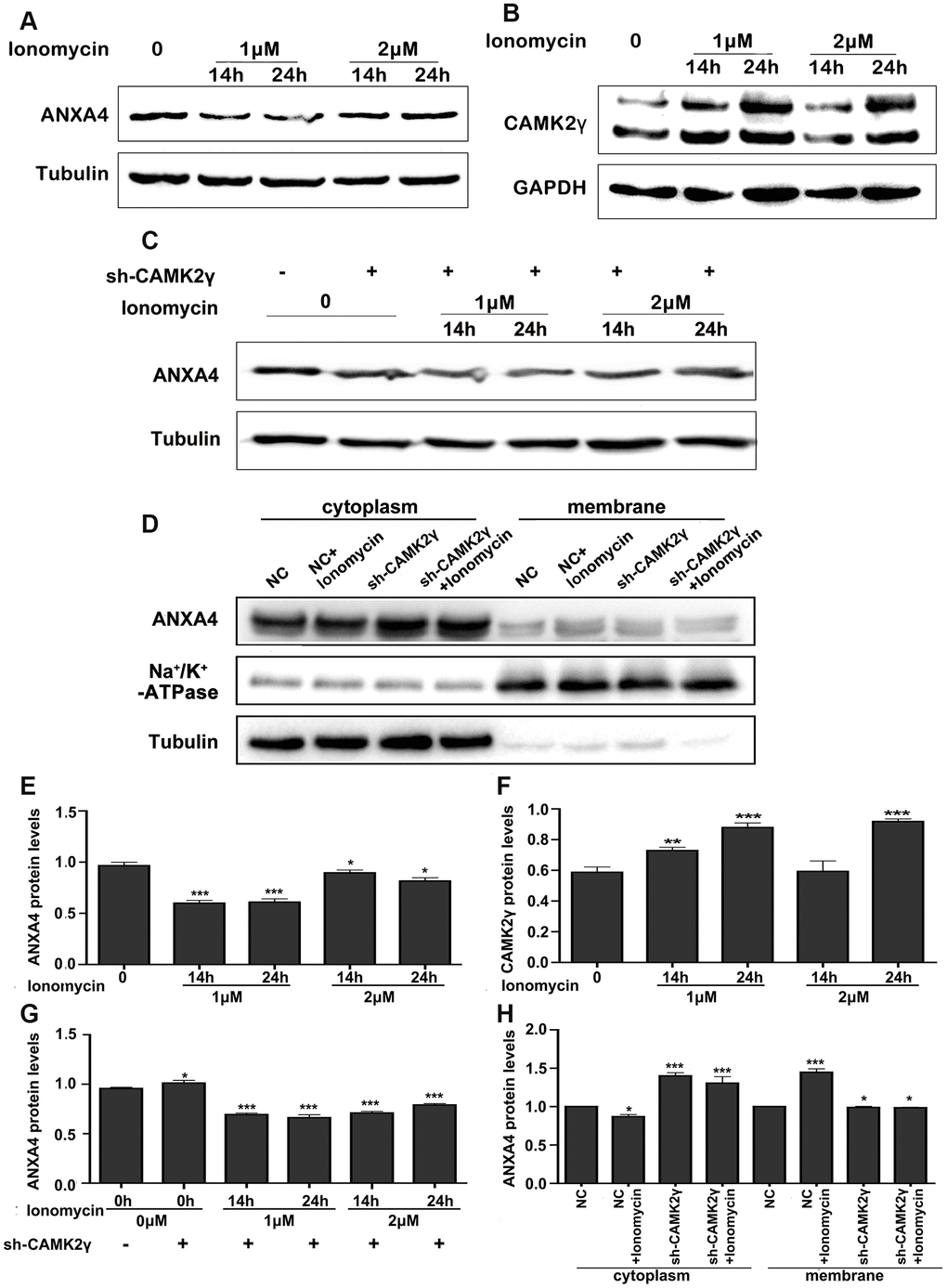 Calcium regulated the expression and location of ANXA4. (A) Time-course expression analysis of ANXA4 after the addition of the Ca2+ agonist ionomycin (1 μM or 2 μM) at 14 h and 24 h. Tubulin was used as the loading control for total protein. *p B) Time-course expression analysis of CAMK2γ after the addition of the Ca2+ agonist ionomycin (1 μM or 2 μM) at 14 h and 24 h. Tubulin was used as the loading control for total protein. *p C) Time-course expression analysis of ANXA4 in HT-29 cells transfected with CAMK2γ after the addition of the Ca2+ agonist ionomycin (1 μM or 2 μM) at 14 h and 24 h. Tubulin was used as the loading control for total protein. *p D) Membrane and cytoplasmic levels of ANXA4 in HT-29 cells transfected with CAMK2γ after the addition of the Ca2+ agonist ionomycin (1 μM) at 14 h. Na/K-ATPase was used as the loading control for cell membrane protein; Tubulin was used as the loading control for total protein. *p E–H) Relative quantitative of comparison of WB analysis mentioned in (A–D). *p 