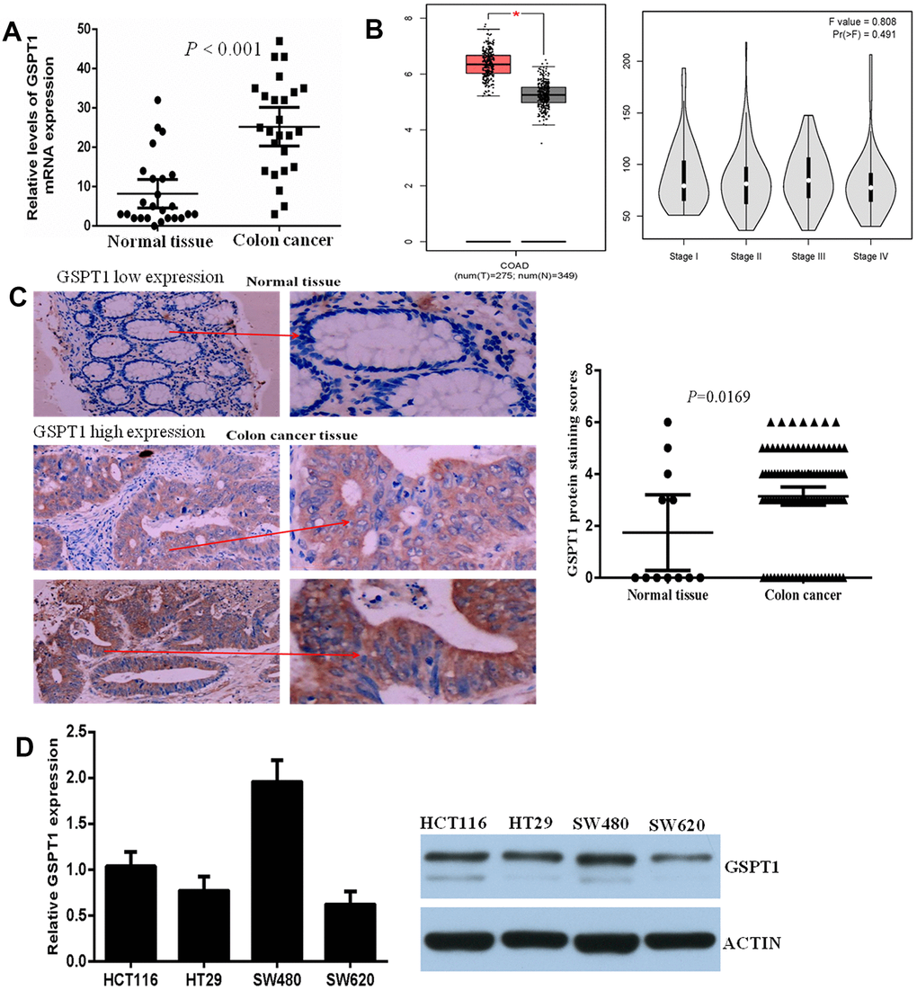 GSPT1 was increased in colon cancer tissues and cell lines. (A) Expression of GSPT1 in the colon cancer tissues and normal tissues were examined by RT-P assay. (B) The expression level of gspt1 in TCGA database. (C) Immunohistochemistry was used to detect the expression of GSPT1 in normal colon and colon cancer. (D) Expression of GSPT1 in the colon cancer cell lines were examined by RT-P and western blot assay.