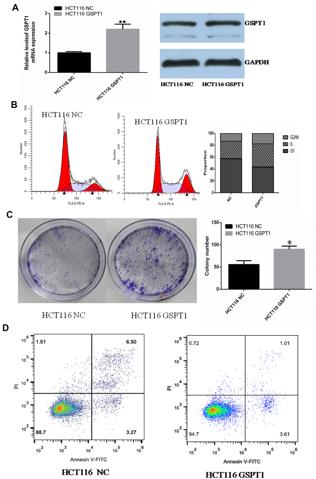 Over-expression of GSPT1 promotes cell cycle progression and inhibits apoptosis in colon cancer cells. (A) Quantitative PCR and WB were used to detect the over-expression efficiency of GSPT1 in colon cancer cell line HCT116. (B) Over-expression GSPT1 promotes cell cycle of colon cancer cell line HCT116. (C) Over-expression of GSPT1 promotes the cloning ability of colon cancer cell line HCT116. (D) Over-expression of GSPT1 inhibits the apoptosis of colon cancer cell line HCT116. * P P 