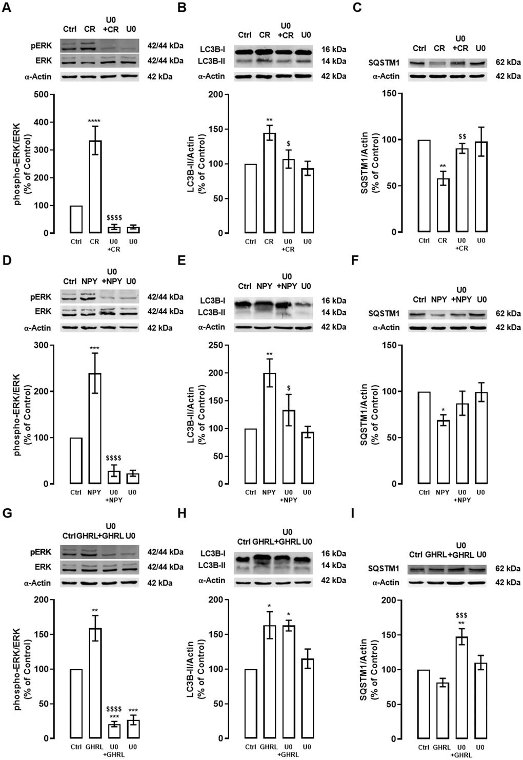 The stimulatory effect of caloric restriction, NPY, and ghrelin on autophagy in cortical neurons is mediated by the activation of ERK1/2-MAPK. Primary rat cortical neurons were exposed to caloric restriction mimic medium (CR) - DMEM low glucose, NPY (100 nM), or ghrelin (GHRL, 10 nM) for 6 h. Untreated cells were used as control (Ctrl). (A–I) Cells were incubated with ERK1/2-MAPK inhibitor (U0126 (U0), 1 μM), 30 min before caloric restriction, NPY or ghrelin treatment. Whole-cell extracts were assayed, phospho-ERK (A, D, G), LC3B-II (B, E, H), SQSTM1 (C, F, I), and ERK or α-Actin (loading control) immunoreactivity through Western blotting analysis, as described in Materials and Methods. Representative Western blots for each protein are presented above each respective graph. The results represent the mean±SEM of, at least, four independents experiments, and are expressed as a percentage of control. *p$p$$p$$$p$$$$p