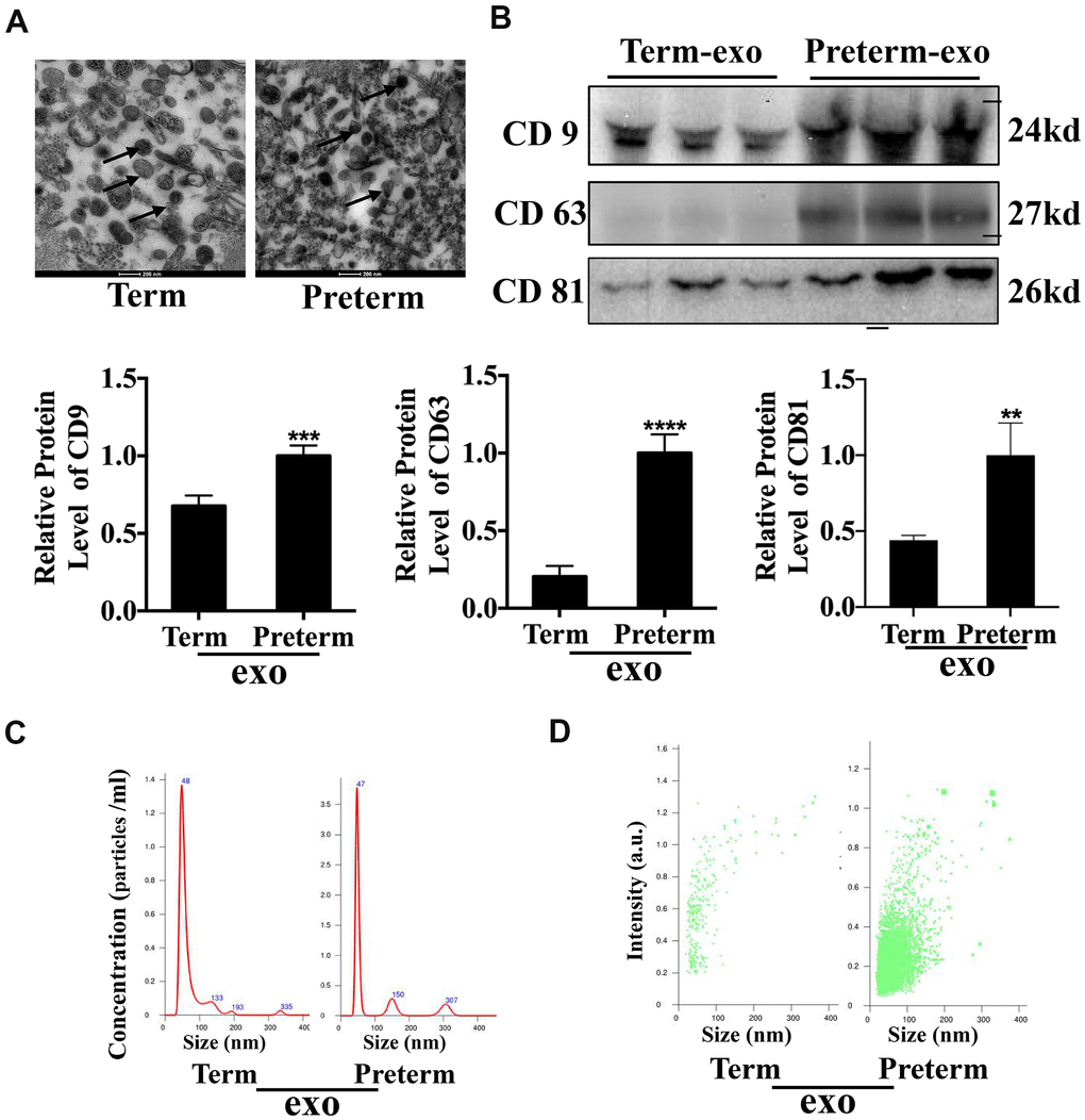 HC Exosome characterization (A) TEM observation of breast milk exosomes showed a typical cup-shaped structure. (B) WB verification of presence of CD9, CD81 and CD63. (C) NTA analysis of preterm and term milk exosomes diameters. (D) Comparison of preterm and term breast milk exosomes abundance.