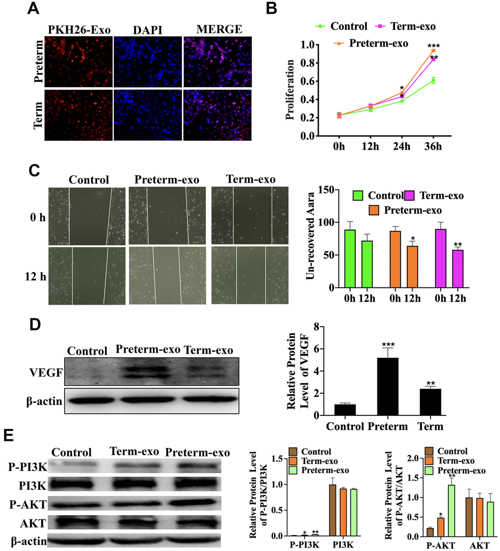 HC exosomes function through the VEGF signalling pathway in small intestinal epithelial cells (FHCs). (A) PKH26 labelled exosomes taken up into the cells, (B) Proliferation of intestinal epithelial cells (FHC); (C) the migration of intestinal epithelial cells (FHC); (D) the VEGF protein expression; (E) P-PI3K/PI3K and P-AKT/AKT protein expression.