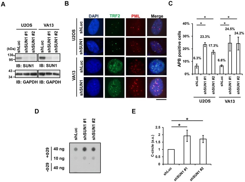 SUN1 knockdown induces APB formation and C-circle levels. (A) U2OS and VA13 cells were infected with control (shLuc) or shSUN1 lentivirus and selected with 1 μg/ml puromycin for 3 days. Cell lysates were subjected to immunoblot analysis with anti-SUN1 and anti-GAPDH antibodies. GAPDH was used as the loading control. (B) Representative images show the colocalization of TRF2 and PML in U2OS cells (upper panel) and VA13 cells (bottom panel). Virus-infected and puromycin-selected cells were subjected to immunofluorescence staining with anti-TRF2 and anti-PML antibodies. DNA was stained with DAPI. Cells containing at least three large TRF2 and PML colocalization foci (yellow) in the nucleus were counted as APB-positive cells. Scale bar, 20 μm. (C) Quantification of APBs (%) in the U2OS and VA13 cells shown in (B). Approximately 200-300 cells were analyzed for each independent experiment. Error bars denote SD; n=3 (independent experiments); *PD) Depletion of SUN1 stimulates the formation of C-circles in U2OS cells. (E) Quantification of the level of C-circles in the cells in (D). The signals were quantified with ImageJ software. The level of C-circles is represented in an arbitrary unit (a.u.). Error bars denote SD; n=3 (independent experiments); *P