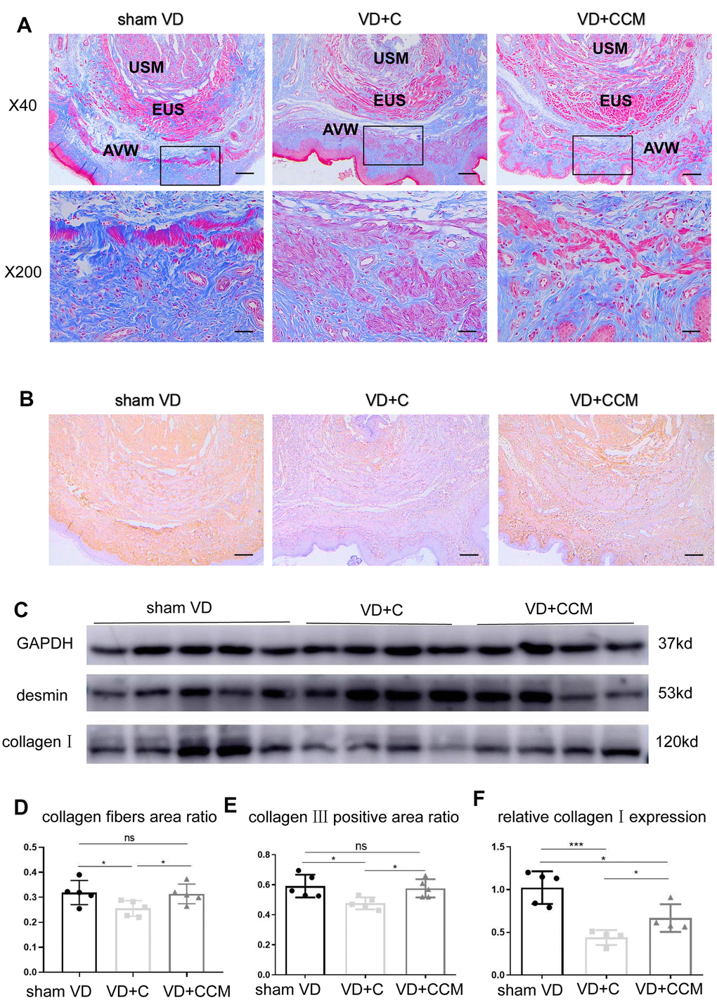 BMSC-CCM treatment promoted collagen content in the middle urethra and adjacent AVW tissues of VD rats. (A, D) Masson’s tricolor staining of the middle urethra and adjacent AVW tissues collected from rats. Collagen fibers were stained blue. The images were magnified 40× (scale bar = 200 μm) and 200× (scale bar = 40 μm). (B, E) IHC showing collagen III (stained brownish yellow) expression in tissues (scale bar = 200 μm). (C, F) The expression of desmin and collagen I was determined by western blotting, and the relative collagen I expression (vs. GAPDH) was analyzed. Data are shown as the means ± standard deviation (SD). *P **P ***P 