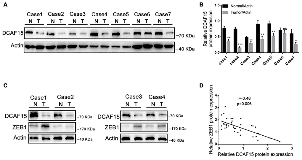 DCAF15 and ZEB1 protein levels negatively correlate in HCC patient specimens. (A–B) In random 7 HCC patient specimens. protein level of DCAF15 in tumor tissues is lower than in normal tissues. (C) Representative western blotting figures show protein expression of DCAF15 and ZEB1 in 40 HCC patient specimens. (D) Correlation analysis of the expression levels of DCAF15 and ZEB1 protein in 40 HCC patient specimens (r = −0.46, p = 0.006).