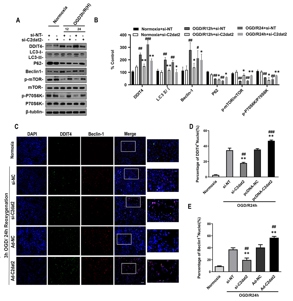 Effect of C2dat2 down-regulation on autophagy in N2a cells after OGD/R. (A) Relative protein expression levels of DDIT4, LC3, P62, Beclin-1, p-mTOR, mTOR, p-P70S6K, and P70S6K were assessed using Western blotting of N2a cells transfected with si-NC or si-C2dat2 12 and 24 h after OGD/R. (B) Relative protein levels were analyzed. Data are mean ± SEM (n = 3). β-Tubulin was blotted as a loading control. (C) Representative images of double immunofluorescent staining of N2a cells with DDIT4 (green) and Beclin-1 (red). (D and E) DDIT4 and Beclin-1 expression was examined using immunofluorescence assay. Data are mean ± SEM. *P **P #P ##P n = 3 per group).