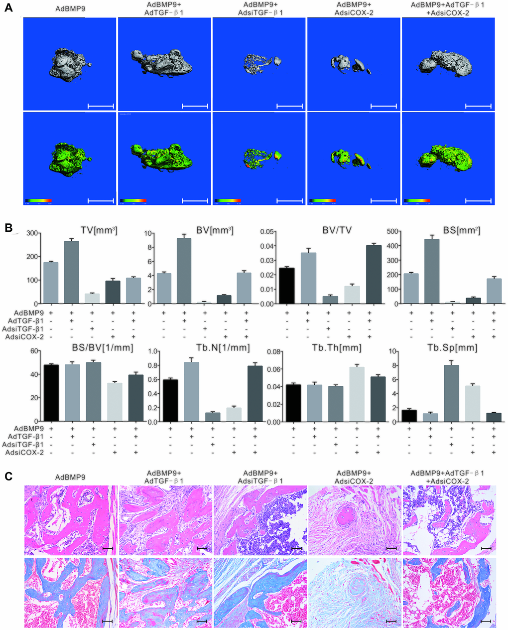 The effect of TGF-β1 and COX-2 knockdown on the osteogenesis induced by BMP9 in C3H10T1/2 cells. (A) The 3D-reconstruction of μ-CT shows that bone formation was affected by TGF-β1, COX-2 knockdown, and/or BMP9. Scale bar = 2.5 mm. (upper panel: reconstructed bone samples; lower panel: heat map showing the bone density of the samples). (B) Quantification of μ-CT shows that the BMP9-induced bone formation was affected by TGF-β1 and COX-2. (C) Histological staining shows the osteogenesis ability was affected by TGF-β1 and/or COX-2. Scale bar = 100 μm. (Upper: H&E staining; lower: Masson trichrome staining).