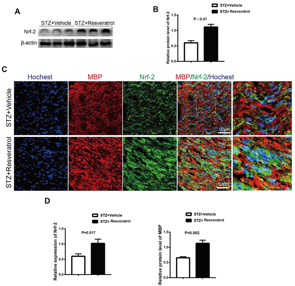 (A, B) Quantification by Western blot analysis showed that the expression of Nrf2 increased in STZ+Resveratrol mice at 12 weeks after STZ injection, compared with the never from STZ+Vehicle mice (n = 3 nerves for each group, data are represented as the mean ± SEM). (C, D) Immunofluorescence in longitudinal sections of STZ+Vehicle and STZ+Resveratrol sciatic nerves for Nrf2 (green) at 12 weeks after STZ injection. Nrf2 and MBP was increased in STZ+Resveratrol. (n = 3 nerves for each group, data are represented as the mean ± SEM).