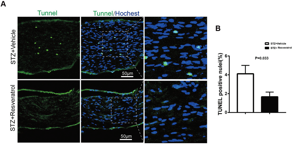 (A, B) TUNEL analysis (green) in longitudinal sections of STZ+Vehicle and STZ+Resveratrol mice stained with the nuclear dye Hoechst (blue) at 12 weeks after STZ injection. (n = 3 animals for each group, data are represented as the mean ± SEM). TUNEL, terminal deoxynucleotidyl transferase dUTP nick end labeling.