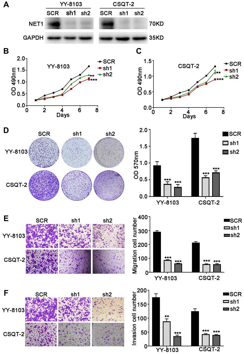 NET1 knockdown inhibits HCC cell proliferation, migration and invasion in vitro. (A) Western blot analysis showing the knockdown efficiency of NET1 in HCC cell lines (YY-8103 and CSQT-2). (B and C) MTT assays showing the effects of NET1 knockdown on the proliferation of YY-8103 (B) and CSQT-2 (C) cells. (D) Crystal violet assays showing the effects of NET1 knockdown on the proliferation of YY-8103 and CSQT-2 cells. Left panel: crystal violet assays. Right panel: OD values of crystal violet assays. (E and F) Transwell assays showing the effects of NET1 knockdown on the migration (E) and invasion (F) of YY-8103 and CSQT-2 cells. Left panel: transwell assays. Right panel: calculation of cells that have migrated (E) or invaded (F) through the filter following eosin staining. All data are presented as mean ± SE. **P ***P 