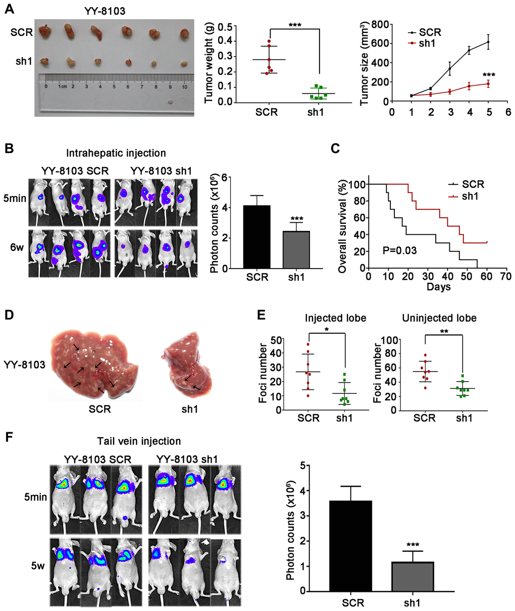 NET1 knockdown suppresses HCC tumorigenesis, and inhibits intrahepatic and lung metastases in vivo. (A) Left panel: representative images of tumors generated by control and NET1-knocked down YY-8103 cells. Middle panel: tumor weight (g). Right panel: tumor growth (mm3). (B) Left panel: representative images showing luciferase expression in intrahepatic tumors of mice from YY-8103 control and shNET1 groups. Right panel: quantification of luciferase expression in intrahepatic tumors. (C) Survival curves of mice in YY-8103 control and shNET1 groups. (D) Representative images of mice livers from YY-8103 control and shNET1 groups with intrahepatic injection. (E) Foci number of injected (left image) and non-injected (right image) lobes of mice with intrahepatic metastasis. (F) Left image: representative images showing luciferase expression from metastasized lungs of mice from YY-8103 control and shNET1 groups. Right image: quantification of luciferase expression in metastasized lungs. All data are presented as mean ± SE. *P **P ***P 