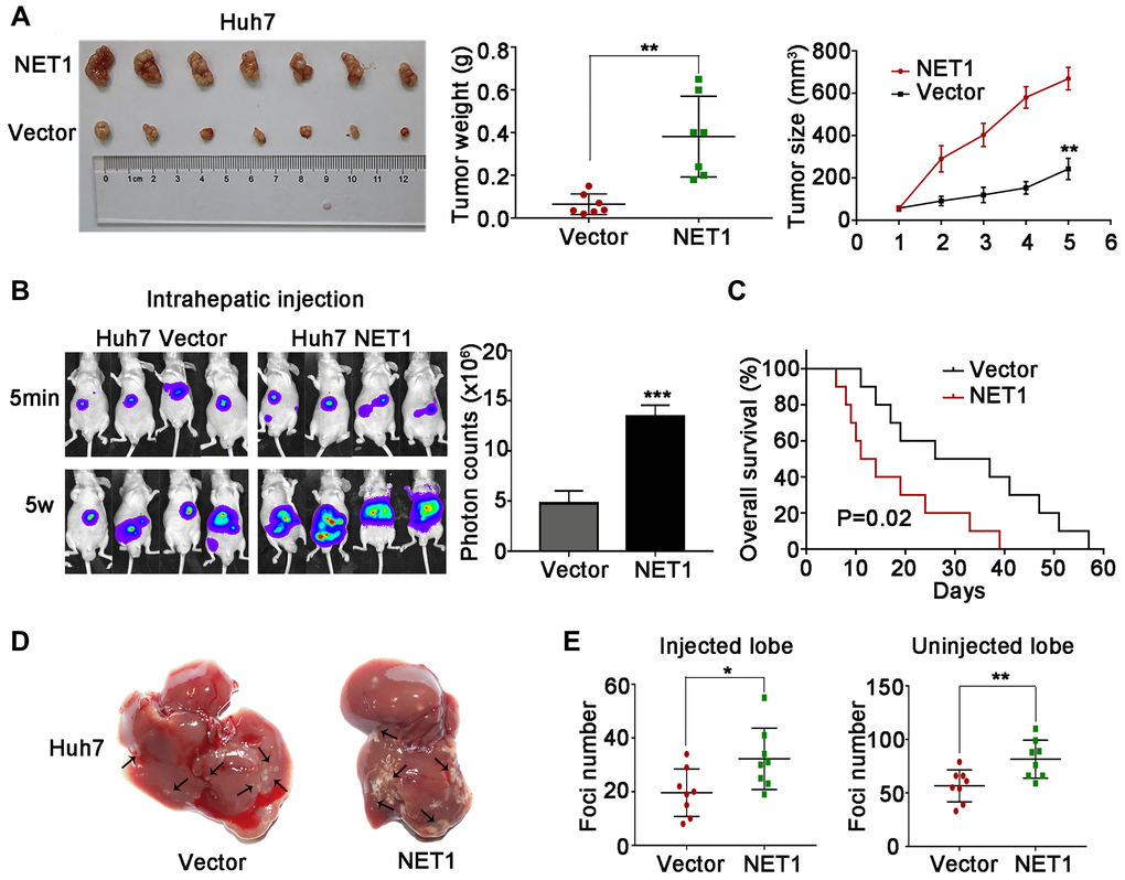 NET1 overexpression promotes HCC tumorigenesis and intrahepatic metastases in vivo. (A) Left image: representative images of tumors generated by control and NET1-overexpressed Huh7 cells. Middle image: tumor weight (g). Right panel: tumor growth (mm3). (B) Left panel: representative images showing luciferase expression in intrahepatic tumors of mice from control and NET1-overexpressed groups. Right panel: quantification of luciferase expression in intrahepatic tumors. (C) Survival curves of mice in Huh7 control and NET1-overexpressed groups. (D) Representative images of mice livers from Huh7 control and NET1-overexpressed groups with intrahepatic injection. (E) Foci number of injected (left panel) and non-injected (right photograph) lobes of mice with intrahepatic metastasis. All data are presented as mean ± SE. *P **P ***P 