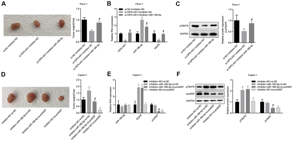 OIP5-AS1 regulates the role of proNGF in promoting cell migration and invasion by targeting the miR-186-5p/NGFR axis. (A) Comparison of the tumour weight of mice in each group. (B, C) OIP5-AS1, miR-186-5p, NGFR mRNA and p75NTR protein levels of tumour tissues in each group. (D) Comparison of the tumour weight of mice in each group. (E, F) Levels of miR-186-5p, NGFR and proNGF mRNA, and p75NTR and proNGF proteins in the tumour tissues of each group.