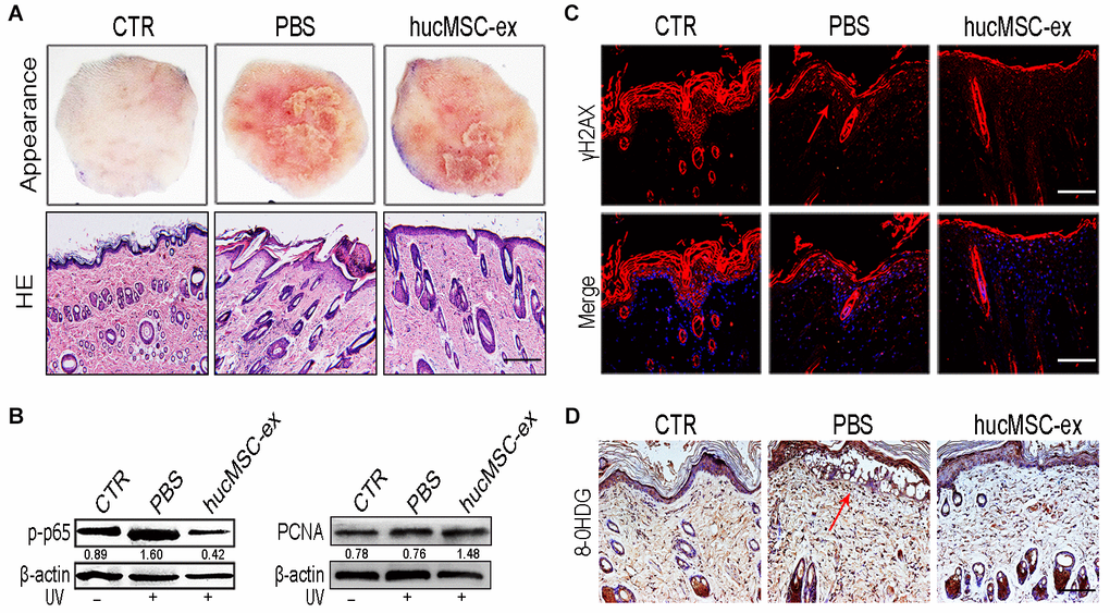 HucMSC-ex protect skin cell from oxidative stress in vivo. (A) Representative images of skin appearance and H&E staining after hucMSC-ex treatment 72 hours significantly inhibited skin inflammation and accelerated skin cell renewal (n=5). Original magnification (100x). (B) p-NF-κB and PCNA expression level quantified by western blot. (C, D): Immunofluorescence and immunohistochemical staining analysis of cutaneous tissues γH2AX and 8-OHDG expression level, Original magnification (200x).