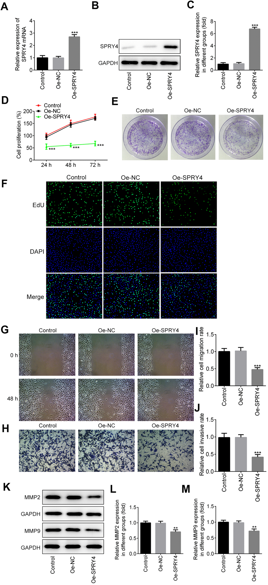 Effects of SPRY4 overexpression on CRC cell proliferation, migration and invasion. The overexpression plasmid of SPRY4 was constructed and transfected into SW480 cells. The mRNA level and protein expression of SPRY4 were detected using RT-qPCR and western blotting, respectively (A–C). Cell proliferation ability was determined using CCK-8 assay (D), cell colony formation (E), and EdU assay (F). Wound-healing and Transwell assays were conducted to measure cell migration and invasion, respectively (G–J). Protein expression of MMP2 and MMP9 was detected by western blotting (K–M). **, ***p