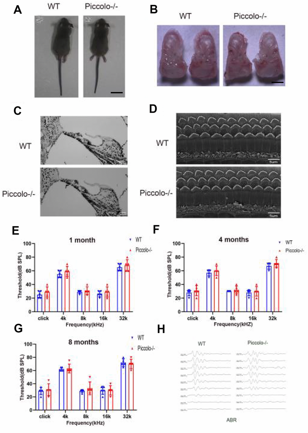 Auditory function of Piccolo-/- mice. (A) Gross morphology of Piccolo-/- and wild type (WT) mice at the age of one month (P30). Scale bar = 2cm. (B) Overall appearance of cochleae from Piccolo-/- and WT mice at P30. Scale bar = 15mm. (C) H&E staining of cochlear sections in Piccolo-/- and WT mice at P30. Scale bar = 20 μm. (D) Scanning electron microscopic images of cochlear hair bundles in Piccolo-/- and WT mice at P30. Scale bar = 5 μm. (E–G) ABR thresholds of Piccolo-/- (n = 3) and WT (n = 3) mice (at the age of one month, 4 months and 8 months, respectively) to click stimuli and to 4, 8, 16, and 32 kHz stimuli. Error bars = Means ± SD. (H) Representative ABR recording from control (n = 5) and Piccolo-/- (n = 3) mice at P30. The asterisk indicates a significant difference between WT and Piccolo-/- mice. *P 