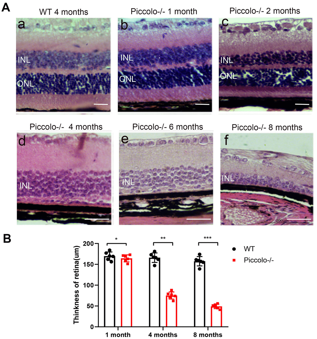 Retinal anatomy in wild type and Piccolo-/- mice. (A) H&E stained sections of retinas from Piccolo-/- and wild type mice at one, two, four, six and eight months of age, respectively. (B) The thickness of retina in Piccolo-/- and wild type (WT) mice (n = 6 per group) at 1, 4 and 8 months; ***P 