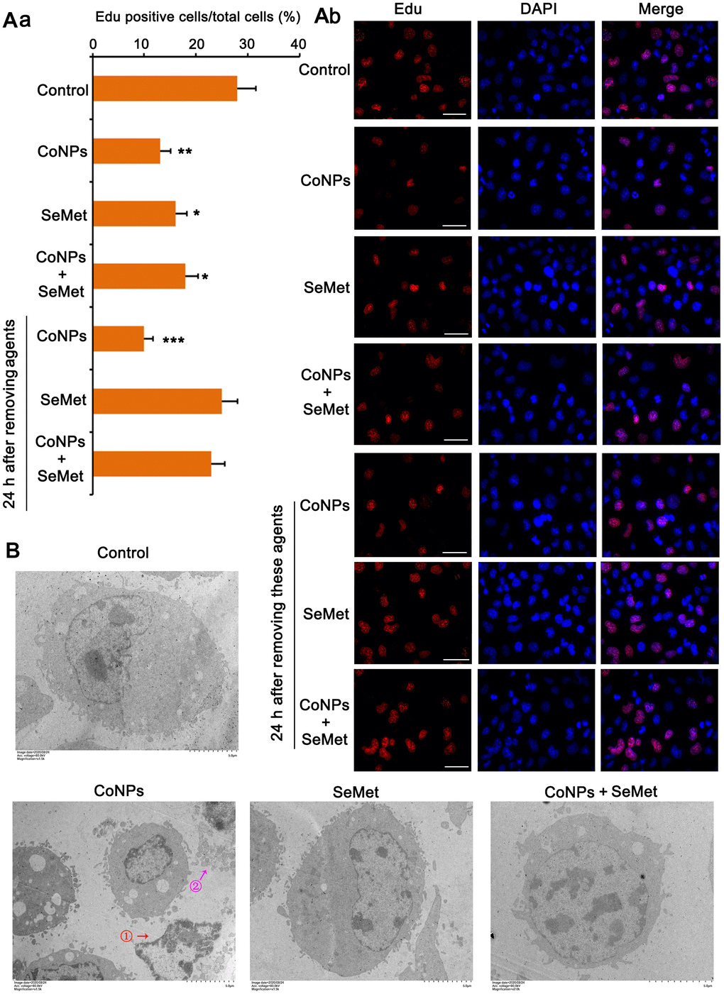 Cell damage was evaluated by cell proliferation assay and electron microscope observation. (A) CD34+ HSC/HPCs were treated with 10 μM SeMet for 15 h or 200 μM CoNPs for 24 h. Alternatively, CD34+ HSC/HPCs were treated with 10 μM SeMet for 15 h before additional treatment with 200 μM CoNPs for 24 h. Edu staining was performed immediately after these treatments were finished. In addition, after these treatments were finished, cells were culture in fresh medium for 24 h before Edu staining. (B) CD34+ HSC/HPCs were treated with 10 μM SeMet and 200 μM CoNPs, alone or in combination, followed by electron microscope observation. *p  0.05, **p  0.01, and ***p  0.001 vs. control cells that did no subjected to any treatments.