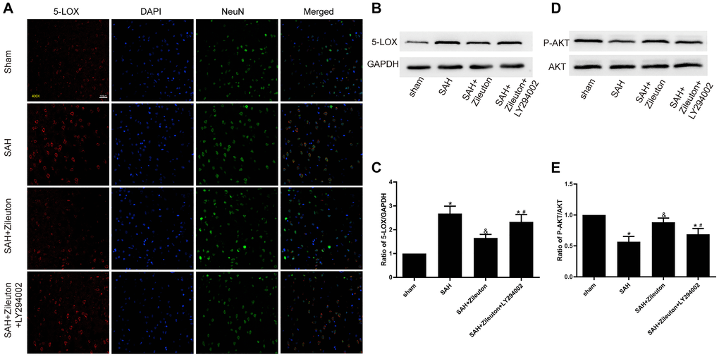 Zileuton decreases 5-LOX expression through PI3K/AKT activation. (A) Immunofluorescent staining for 5-LOX (red) and NeuN (green) in the cortex of rats in the sham, SAH, SAH + Zileuton and SAH + Zileuton + LY294002 groups. Nuclei were counterstained with DAPI (blue). Final magnification, 400×; scale bars = 100 μm, n = 6 per group. (B–E) Representative images and quantitative analysis of 5-LOX and p-AKT after Zileuton treatment with and without LY294002. N = 6 in each group, *P &P #P 