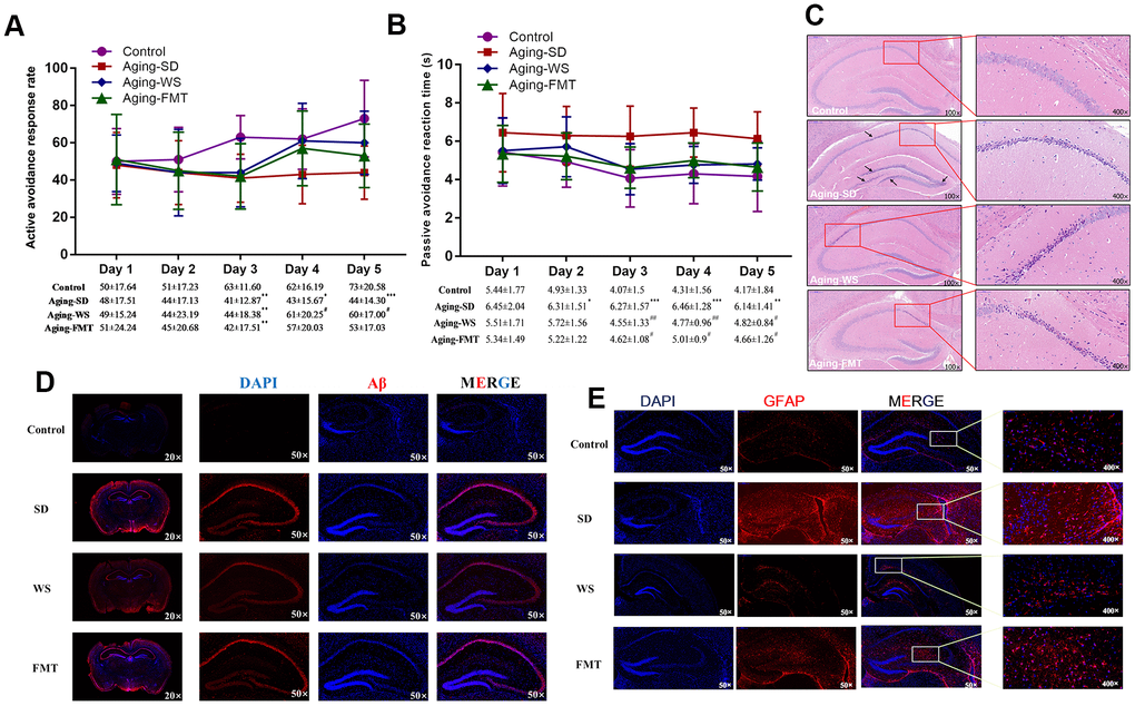 Effects of WS on the learning memory and the neuronal molecules in mice. (A) The ratio of active avoidance response (%). (B) Passive avoidance reaction time (s). *P P P #P ##P ###P C) Images of the HE stained hippocampus in the mouse cerebrum at 100× and 400× magnification. (D) Immunohistochemical images of Aβ expression in tissues from the mouse cerebrum at 20× and 400× magnification. (E) Immunohistochemical images of GFAP expression in tissues from the mouse cerebrum at 50× and 400× magnification.