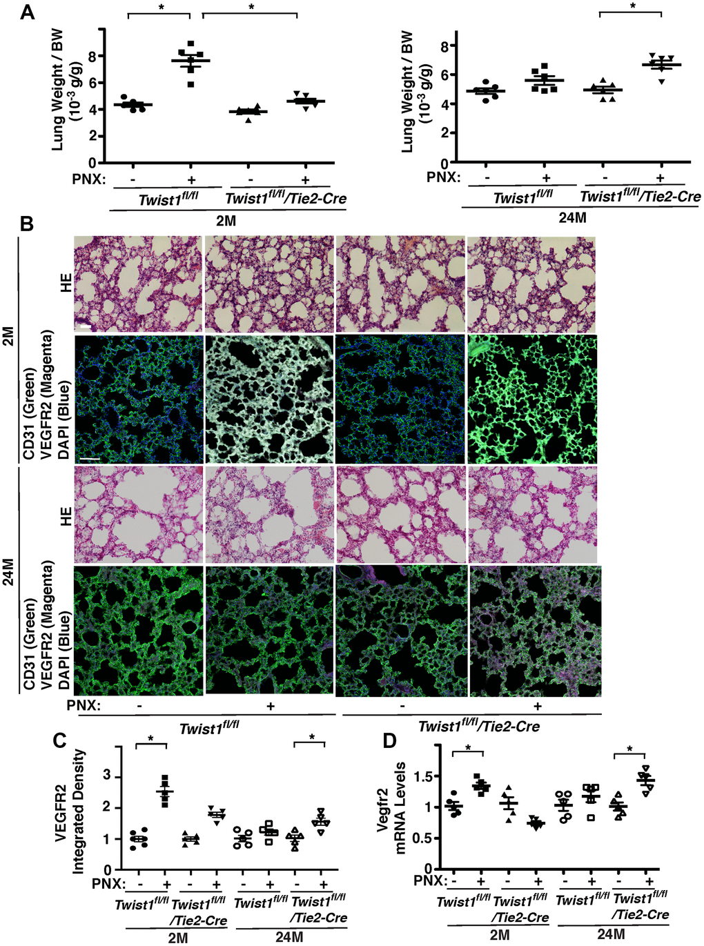 Endothelial Twist1 mediates age-dependent inhibition of post-PNX compensatory lung growth. (A) Graphs showing the ratio of the weight of right lung cardiac lobe to mouse BW in the 2M vs. 24M old Twist1fl/fl or Twist1fl/fl/Tie2-cre mice after PNX (n=6, mean ± s.e.m., *, pB) H&E-stained mouse lungs in the cardiac lobe of 2M vs. 24M old Twist1fl/fl or Twist1fl/fl/Tie2-cre mice after PNX (top, 3rd) Scale bar, 25 μm. IF micrographs showing staining of CD31, VEGFR2 and DAPI in 2M vs. 24M old Twist1fl/fl or Twist1fl/fl/Tie2-cre mice after PNX (2nd, bottom). Scale bar, 100 μm. (C) Graph showing integrated density of VEGFR2 in 2M vs. 24M old Twist1fl/fl or Twist1fl/fl/Tie2-cre mice after PNX (n=5-6, mean ± s.e.m., *, pD) Graph showing the mRNA levels of Vegfr2 in the ECs isolated from 2M vs. 24M old Twist1fl/fl or Twist1fl/fl/Tie2-cre mouse lungs after PNX (n=5, mean ± s.e.m., *, p