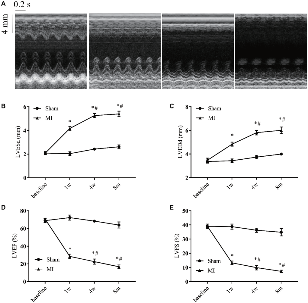 Serial echocardiographic assessment of post-infarction remodeling. (A) Representative recordings of M-mode echocardiographic images at indicated time points. (B) Left ventricular end-systolic diameter (LVESd). (C) Left ventricular end-diastolic diameter (LVEDd). (D) Left ventricular systolic function presented by the left ventricular ejection fraction (LVEF). (E) Left ventricle fractional shortening (LVFS). *P #P n = 8–10 at various time points.