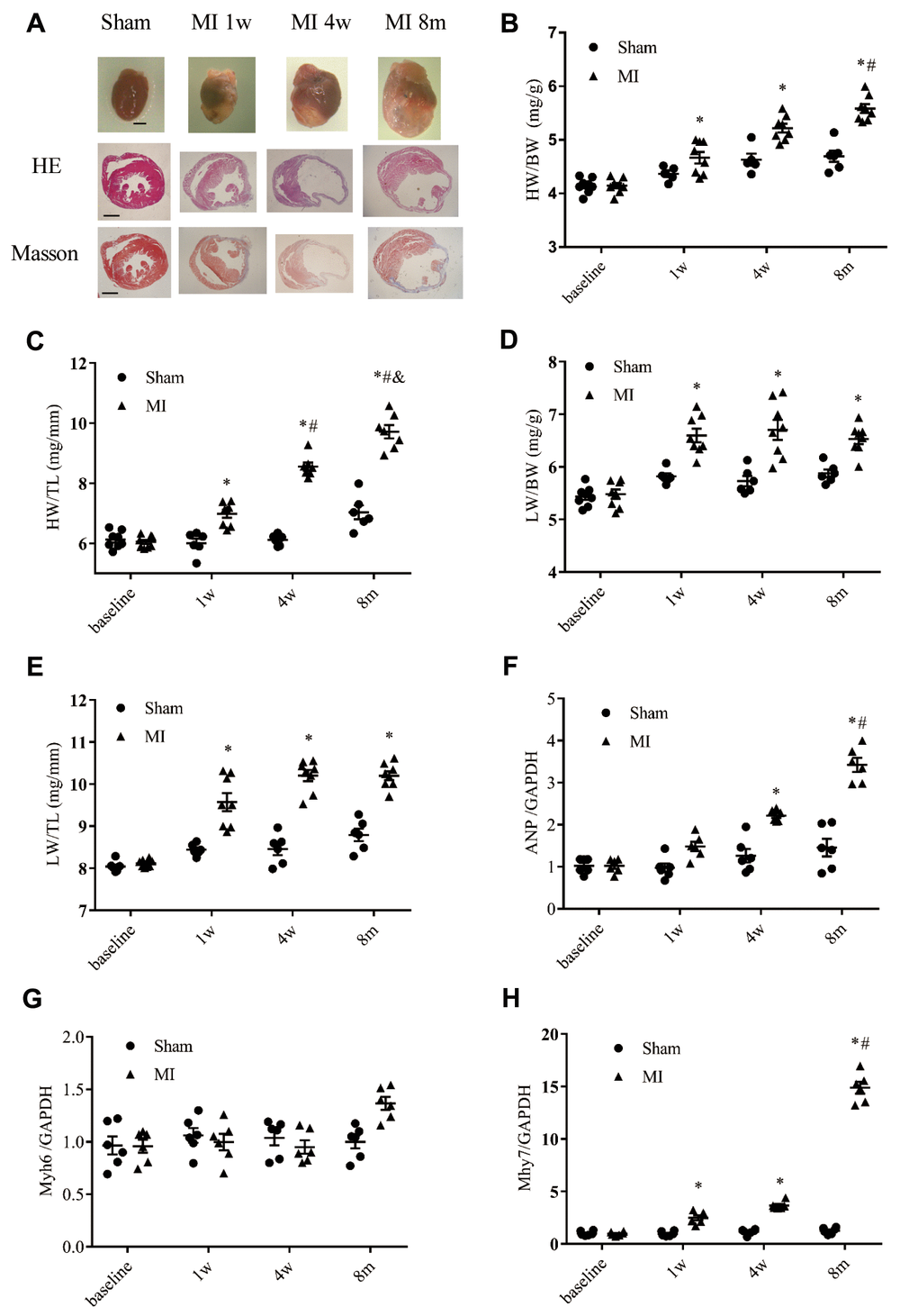 Cardiac remodeling validated by morphological and histological analysis. (A) Representative images of whole hearts and cross sections of hearts stained with hematoxylin-eosin staining (HE) and Masson's trichrome staining from different time points (scale bar = 2 mm). (B) Heart weight to body weight ratio (HW/BW). (C) Heart weight to tibia length ratio (HW/TL). (D) Lung weight to body weight ratio (LW/BW). (E) Lung weight to tibia length ratio (LW/TL); n = 8–10 at different time points. (F) Expression of the gene encoding ANP (atrial natrium peptide). (G) Expression of the gene encoding α-MHC (α-myosin heavy chain, Myh6). (H) Expression of β-MHC (Myh7); n = 6 at each time point. *P #P 