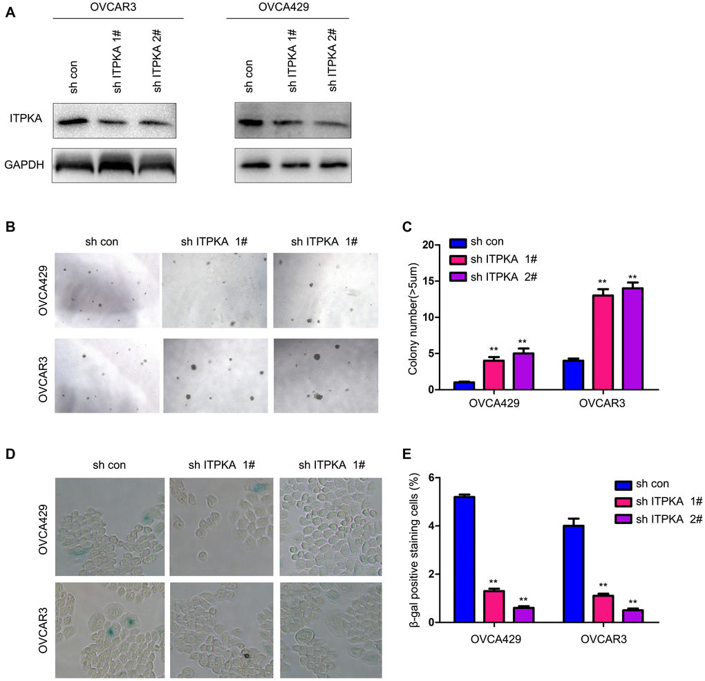 Knocking down ITPKA promoted colony formation and inhibited cell senescence in ovarian cancer. (A) Knockdown of ITPKA in OVCAR3 and OVCA429 cells. Cells were infected with a lentivirus for 8 hours. After selection, the resistant cells were examined for ITPKA expression. (B) Effects of ITPKA knockdown on the colony formation of OVCAR3 and OVCA429 cells were examined using a soft agar assay. (C) Statistical analysis of (B). (D) Effects of ITPKA knockdown on the senescence of OVCAR3 and OVCA429 cells were examined using β-gal staining. (E) Statistical analysis of (D). **P 