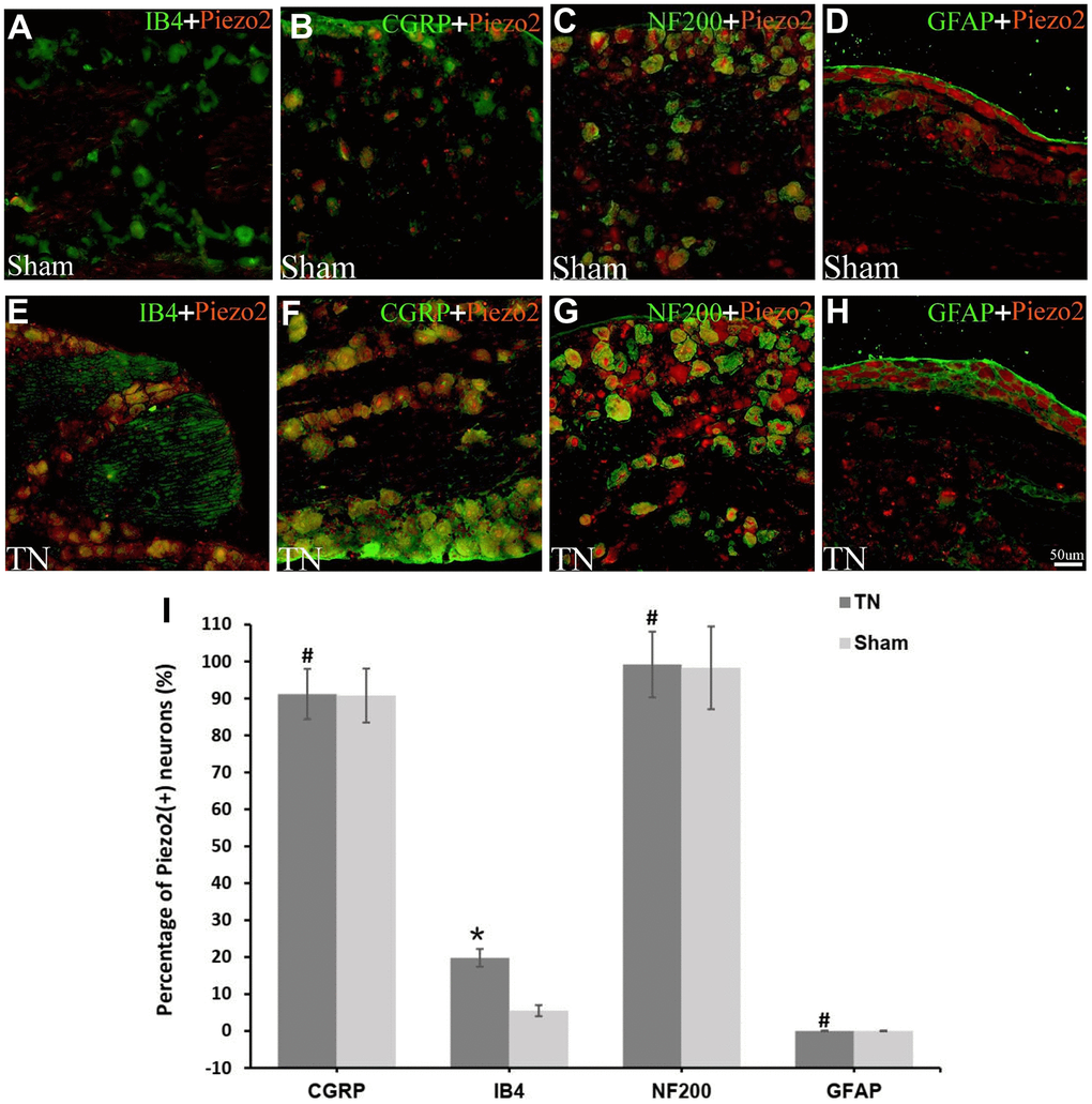 Double immunofluorescence staining of Piezo2. Double immunofluorescence staining results are displayed. The red refers to Piezo2, the green refers to IB4 (a marker for C-type neurons), CGRP (a marker for small nociceptive peptidergic neurons), NF-200 (a marker for A-type neurons) or GFAP (a marker for satellite glial cells), and the yellow refers to the colocalization (A–H). With calculation, the percentage of Piezo2 in IB4 neuron outnumbers those in the other neurons significantly (19.8±2.4% vs. 5.5±1.5%, pI).