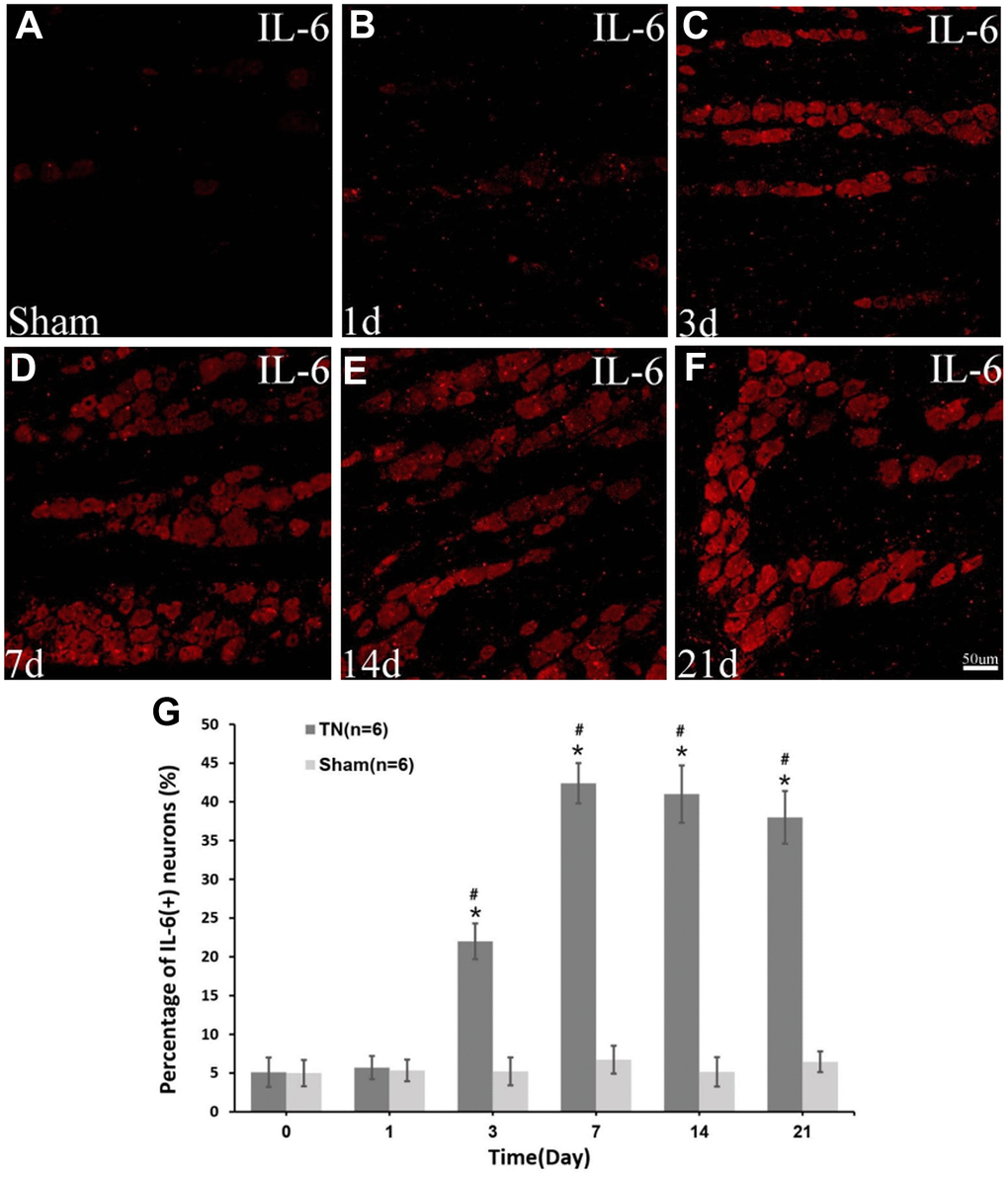 Immunocytochemistry of IL-6. Immunocytochemistry images of IL-6 in sham group (A) and TN group at different time points (B–F) are demonstrated. The percentage of IL-6 (+) neuron increases at day 3 postoperatively, reaching peak at day 7 (42.4±2.6% in TN group vs. 6.7±1.8% in sham group, pG).