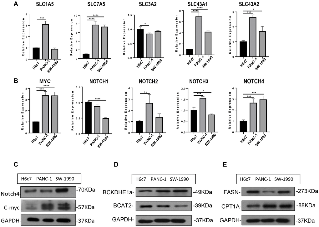 Experimental verification of the bioinformatic results. (A) mRNA expression of SLC carriers in H6c7, PANC-1 and SW-1990 cell line. (B) mRNA expression of MYC and NOTCH in H6c7, PANC-1 and SW-1990 cell line. (C–E) Protein expression of MYC, NOTCH4, BCAT2, CPT1A and FASN in H6c7, PANC-1 and SW-1990 cell line.