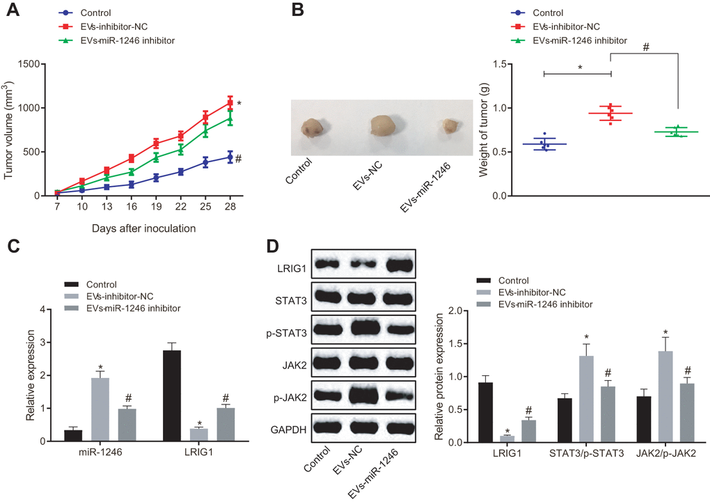 AML cell-derived EVs deliver miR-1246 inhibitor to restrain the growth of transplantation tumors of LSCs. Mice were subcutaneously injected with normal saline, EVs-inhibitor-NC and EVs-miR-1246 inhibitor. (A, B) Tumor formation in mice observed and recorded in real time. (C) Expression of miR-1246 and LRIG1 in tumor tissues of mice tested by RT-qPCR. (D) Expression of LRIG1 and STAT3-related proteins in tumor tissues of mice detected by western blot analysis. * p vs. mice injected with normal saline. #p vs. mice injected with EVs-inhibitor-NC. n = 6. Data in the figures are all measurement data, expressed as mean ± standard deviation. Data among multiple groups were analyzed by one-way ANOVA. Data among multiple groups at different time points were measured by repeated measurement ANOVA.