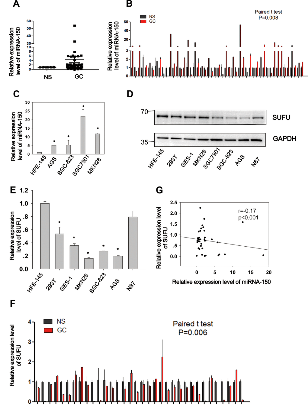Negative correlation between miRNA-150 and SUFU in GC. MiRNA-150 is highly expressed in GC. The expression of SUFU is downregulated in GC and negatively correlated with the expression of miRNA-150. (A, B) The expression levels of miRNA-150 in 50 paired GC tissues are shown. (C) The expression levels of miRNA-150 in GC cell lines, namely BGC-823,AGS,SGC7901,N87 and MKN28 cells and normal epithelial cells (HFE-145, 293T, GES-1) were determined. (D, E) The expression levels of SUFU in GC cell lines were determined using western blotting and qPCR. (F) The expression levels of SUFU in 34 paired GC samples are shown. (G) A correlation analysis of miRNA-150 and SUFU mRNA levels was performed in 34 paired GC tissues.