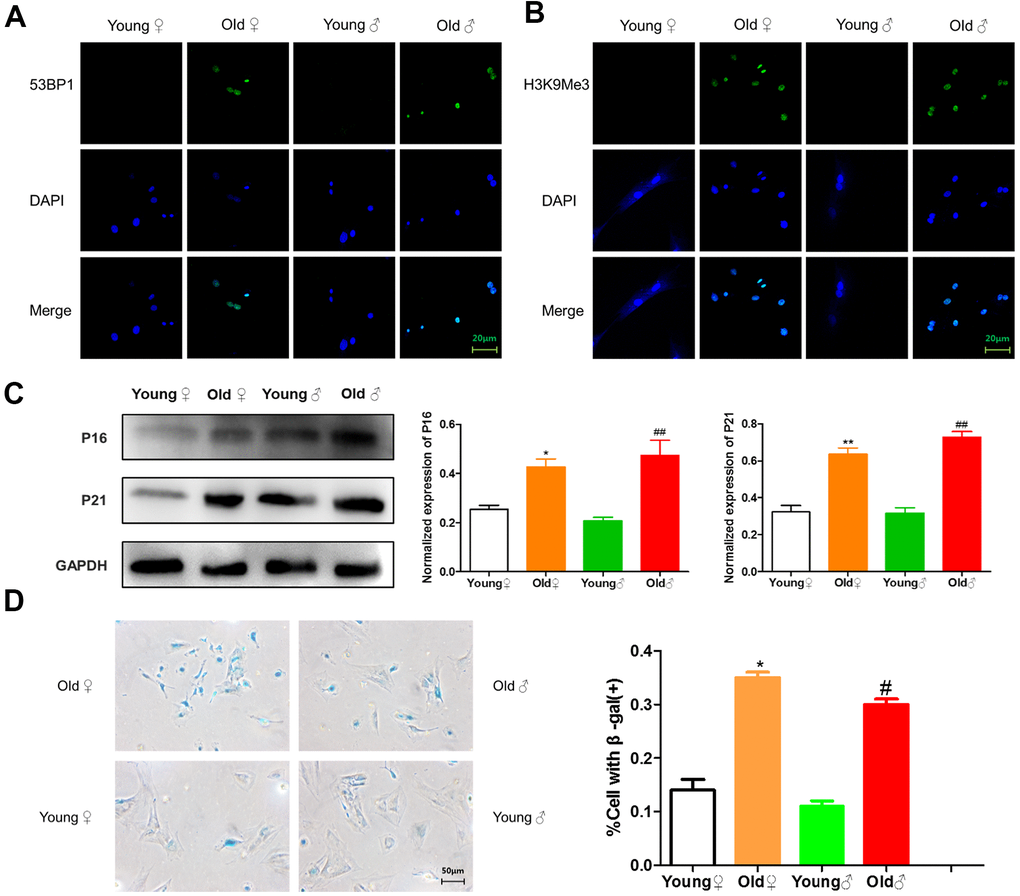 Senescence identification of BMSCs in aged and young rats. (A) 53BP1 immunofluorescence staining of aged and young rat BMSCs; (B) H3K9Me3 immunofluorescence staining of aged and young rat BMSCs; (C) Senescence marker protein assay and relative protein expression statistics of aged and young rat BMSCs (x¯±s,n=3); (D) β-Galactosidase staining plots and statistical plots of the percentage of positive β-galactosidase staining cells (x¯±s,n=3); *P #P ##P 