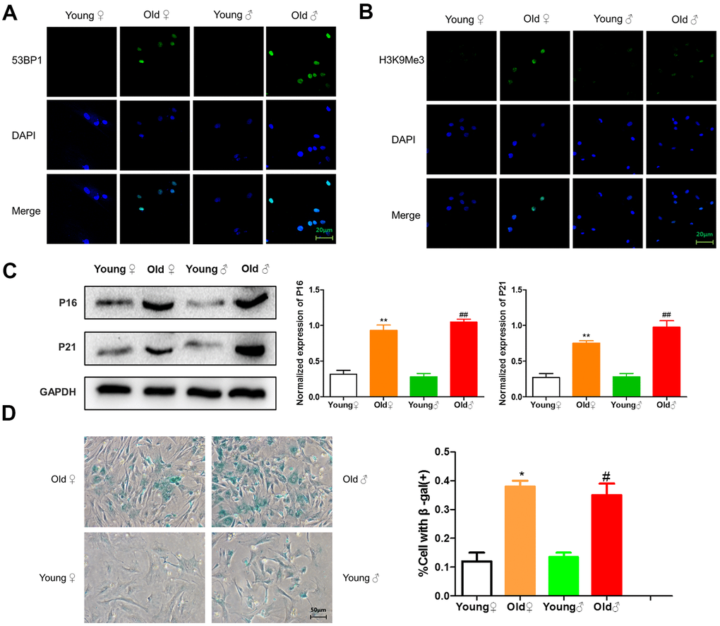 Senescence identification of osteoblasts in aged and young rats. (A) 53BP1 immunofluorescence staining of aged rat and young rat osteoblasts; (B) H3K9Me3 immunofluorescence staining of aged rat and young rat osteoblasts; (C) Senescence marker protein assay and protein relative expression statistics of aged rat and young rat osteoblasts (x¯±s,n=3); (D) β-Galactosidase staining plots and statistical plots of the percentage of positive β-galactosidase staining cells (x¯±s,n=3); *P #P ##P 