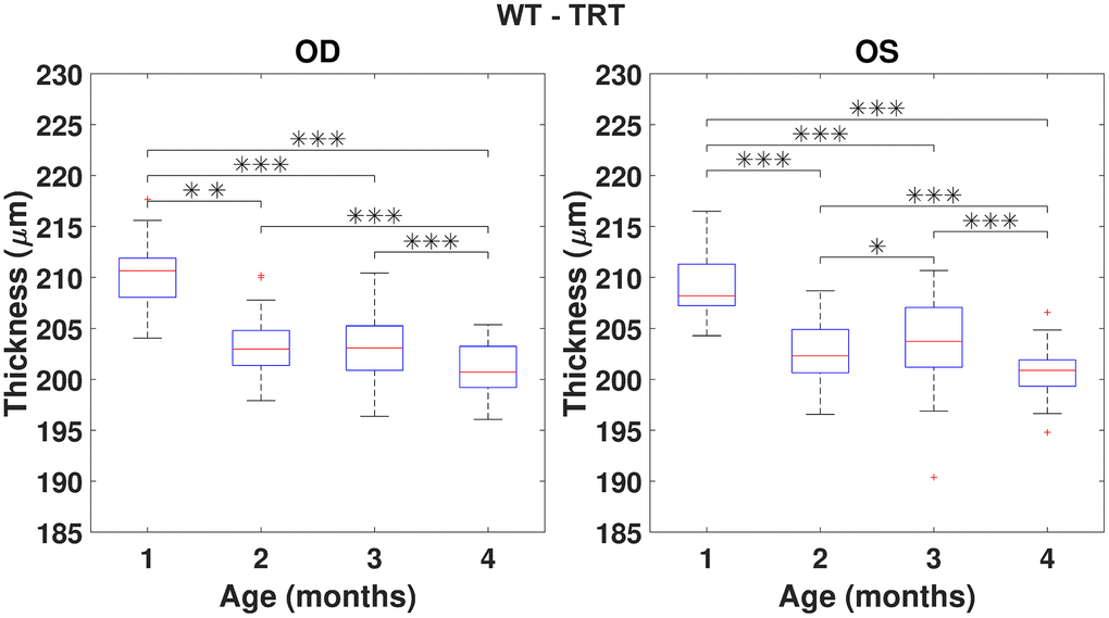 Boxplot of the total retinal thickness (TRT) (in μm) for each time point, for right (OD) and left (OS) eyes of WT mice (respectively, left and right graphs). One, two and three asterisks represent, respectively, statistically significant differences at the level of 5%, 1% and 0.1%, based on pairwise comparisons. No statistically significant differences were found when comparing right to left eyes at any time point.