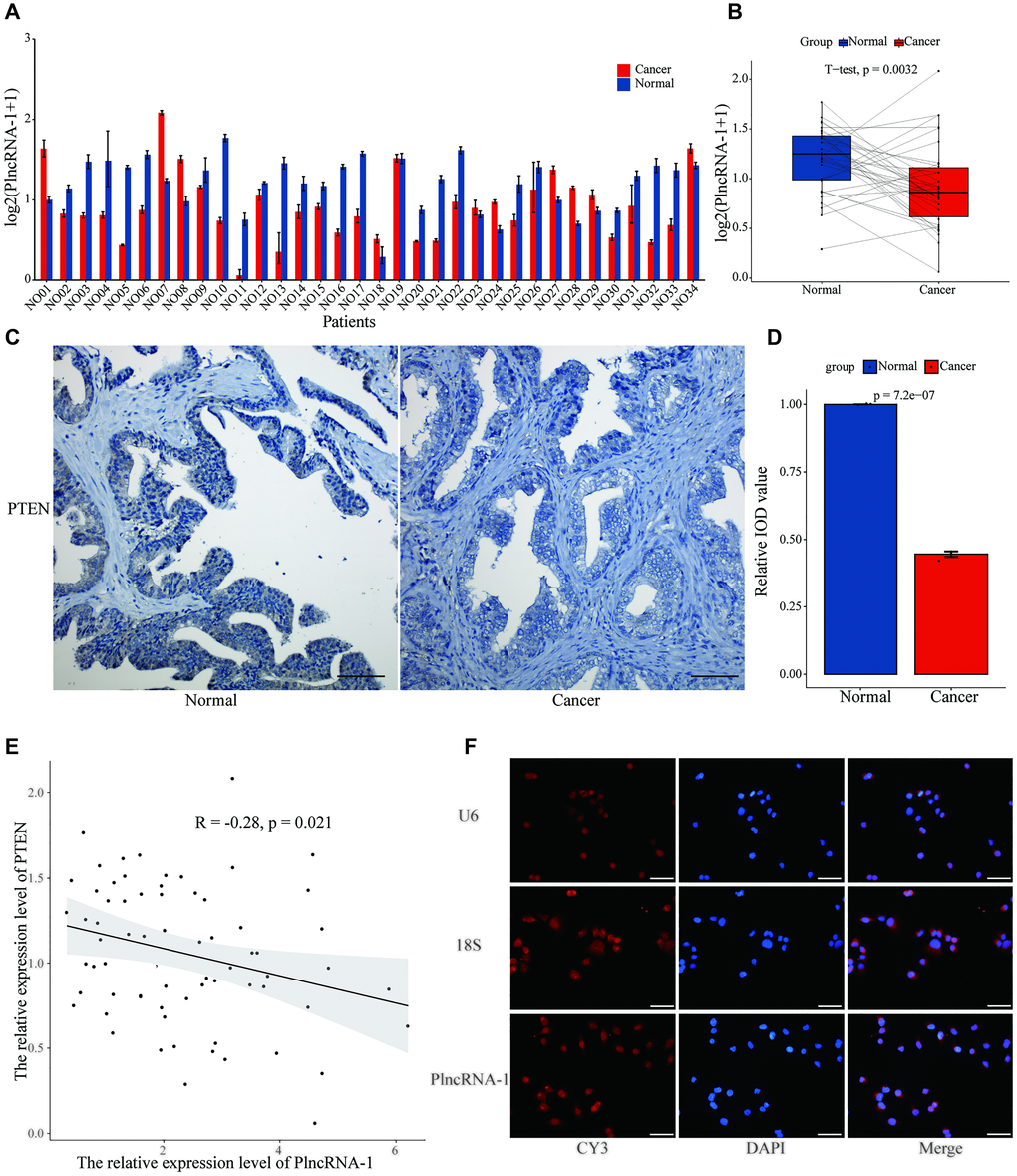 The relationship between PTEN and PlncRNA-1. (A–B) The expression level of PTEN in 34 pairs of PCa and normal matched tissues. (C) Immunohistochemistry assay for the expression of PTEN in the PCa and normal matched tissues (Scale bar, 100 μm). (D) Quantitative analysis immunohistochemistry assay for the expression of PTEN in the PCa and normal matched tissues. (E) The correlations between level of PlncRNA-1 expression and PTEN in PCa tissues. (F) RNA-FISH images for subcellular localization of PlncRNA-1 in PCa cells (Scale bar, 50 μm).