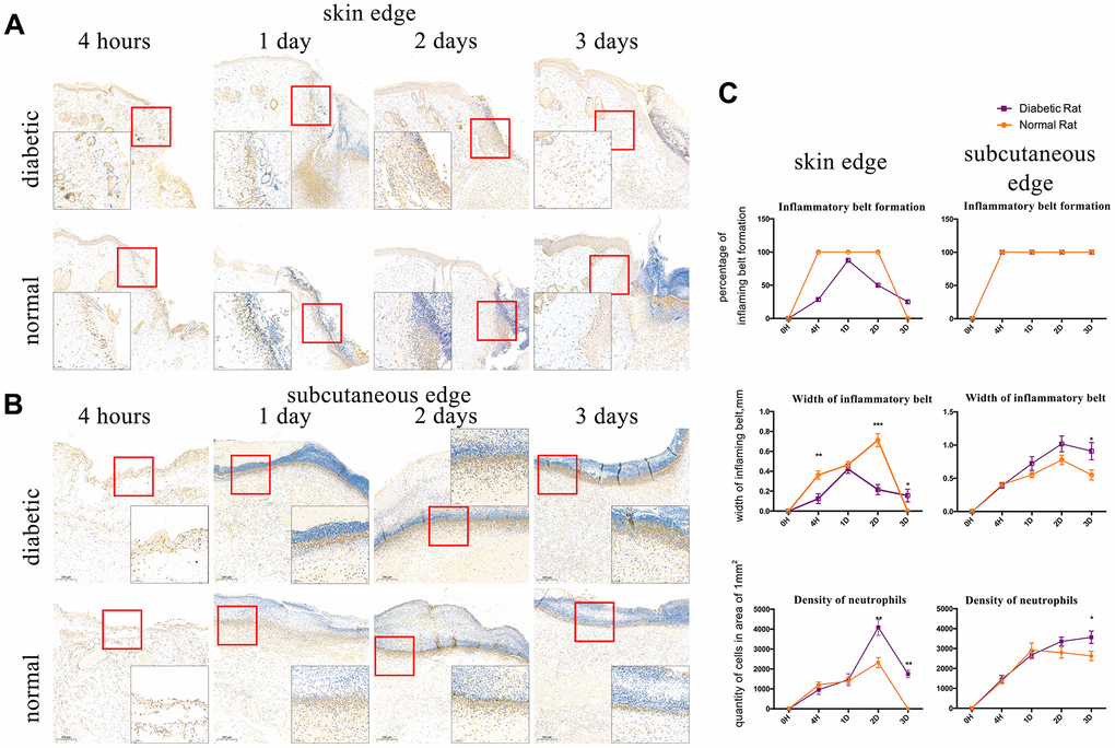 Interleukin-8 receptor A (IL8-RA) immunohistochemical staining to determine the formation and width of the inflammatory belt and density of neutrophils. (A) IL8-RA immunohistochemical staining of skin tissues. (B) IL8-RA immunohistochemical staining of subcutaneous tissues. (C) Comparation of inflammatory belt formation, inflammatory belt width, and density of neutrophils. The blue circle indicates abnormal neutrophil aggregation under the dermis of diabetic rat. *: P