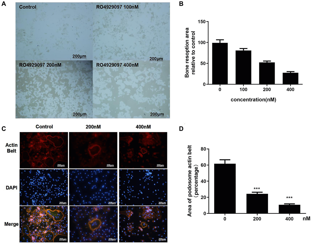 Podosome actin belt formation and OC-mediated bone resorption activity was inhibited by RO4929097. (A) OCL were seeded onto Osteo Assay Stripwell Plates with RANKL (100 ng/mL), M-CSF (33.3 ng/mL), and RO4929097 (0,100, 200, and 400 nM) for four days (B) The resorption area in Osteo Assay Stripwell Plates. (C) BMMs were cultured in 48-well plates with 0, 100, 200, and 400 nM RO4929097 for five days. The cells were fixed and stained for immunofluorescence. (D) Area of OCs with an F-actin belt. The data were presented as the mean ± SD.