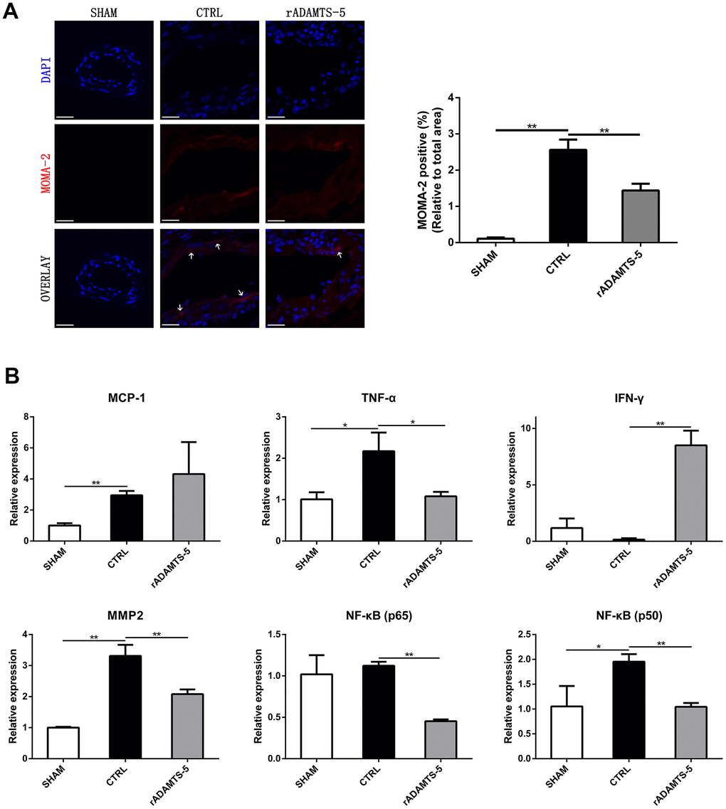 Effects of rADAMTS-5 on monocyte/macrophage infiltration and inflammatory mediators within the IA artery. (A) Immunostaining for macrophages (white arrow) with MOMA-2 (red) of arterial sections of the sham group, control group (CTRL), and rADAMTS-5-administered group. Scale bar, 40μm. (B) Effects of rADAMTS-5 treatment on the mRNA levels of inflammatory mediators. *PP
