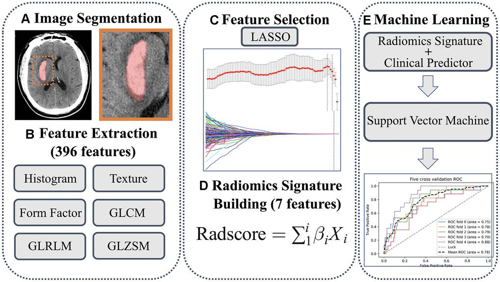 (A) Regions of interest were manually segmented. (B) A total of 396 features were extracted. (C) Features were selected using LASSO method. (D) Rad-score was calculated. (E) Predicting model was developed using support vector machine.