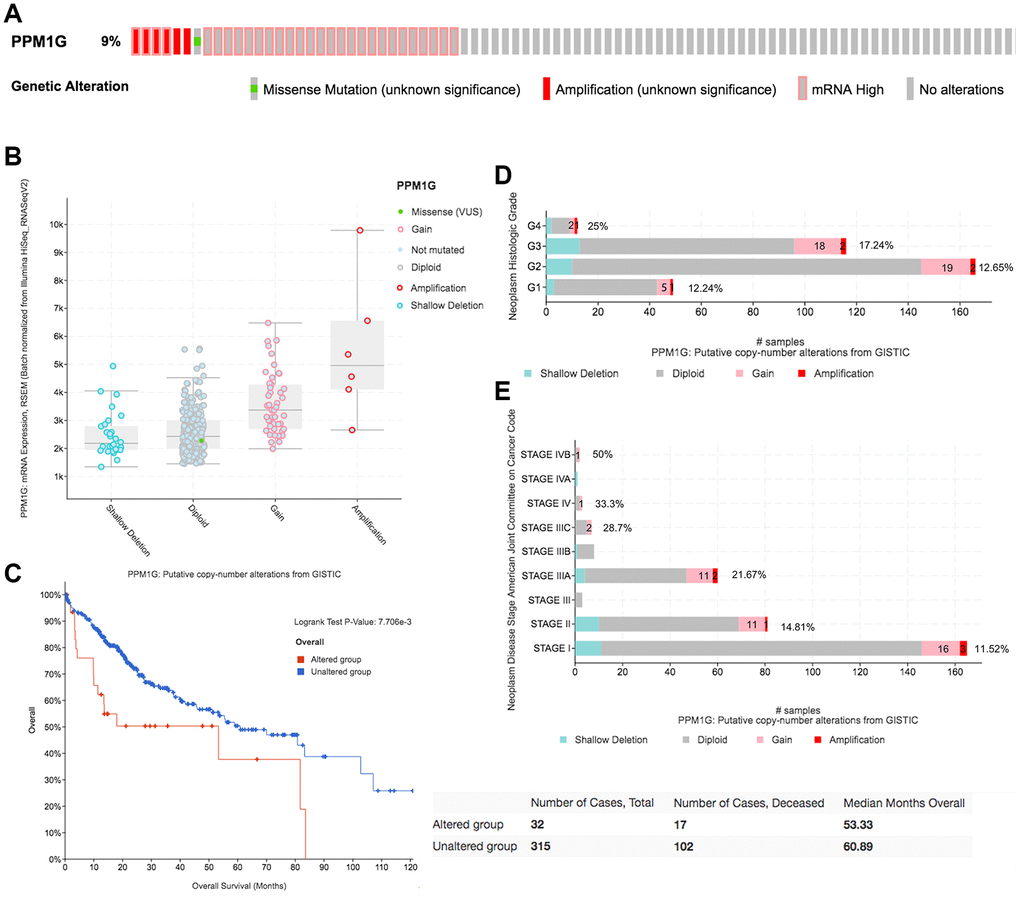 CNAs of PPM1G in LIHC (cBioPortal). (A) OncoPrint plot of PPM1G alterations in the LIHC cohort. The different types of genetic alterations are highlighted in different colors. (B) Correlation between PPM1G expression and CNAs in LIHC. The PPM1G amplification (AMP) group had significantly increased expression. (C) Distribution of PPM1G CNV frequency across different grade subgroups. (D) Distribution of PPM1G CNV frequency across different stage subgroups. The percentage on the right of the bar indicates the proportion of patients with PPM1G gain or AMP in all subgroups of patients. (E) PPM1G CNV affects overall survival.