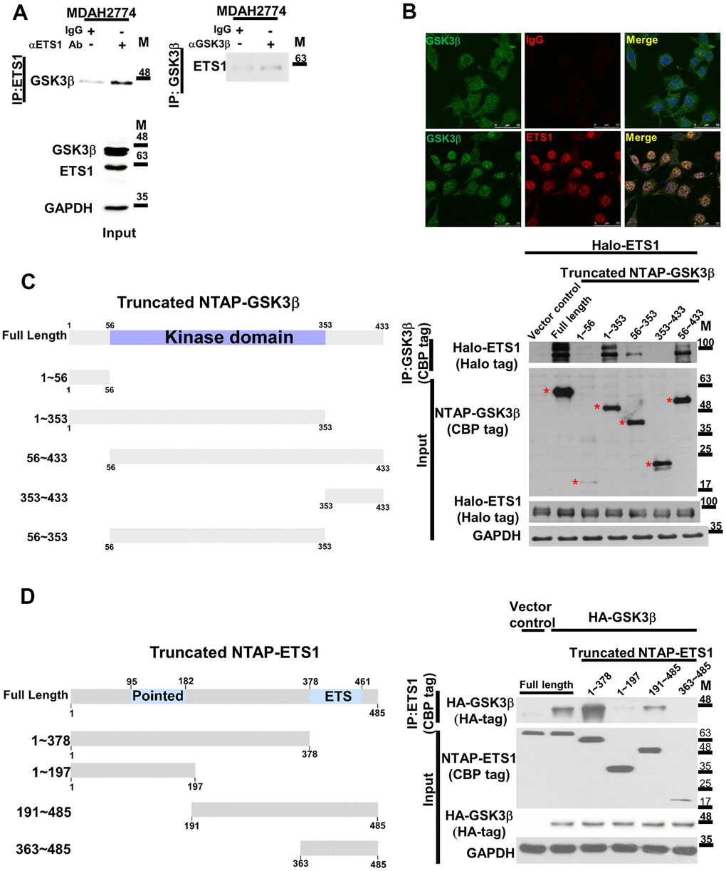 The GSK3β phosphorylation complex includes ETS1. (A) The endogenous GSK3β-ETS1 complex was pulled-down in ovarian cancer cell lysates (MDAH2774) using an anti-ETS1 antibody (left panel), an anti-GSK3β antibody (right panel), and a control IgG. The associated GSK3β protein (ETS1 antibody pull-down, left panel) or ETS1 (GSK3β antibody pull-down, right panel) were determined by western blot. Levels of endogenous GSK3β and ETS1 are shown in the lower panel. (B) Confocal microscopy revealed the presence of a GSK3β-ETS1 complex in MDAH2774 cells. Cells were double-stained with the GSK3β antibody (green signal, left panel), the ETS1 antibody (red signal, middle lower panel), or the control IgG (middle upper panel). Two proteins showed colocalization (yellow signal) as revealed by overlapping green and red signals (right panel). (C) 293 cells were transfected with full-length ETS1 (Halo-ETS1) and control vector, the full length and truncated GSK3β constructs (CBP tag). The presence of ETS1 aggregated in a complex was examined with an anti-Halo tag antibody. Asterisks indicate the full length and truncated GSK3β protein. The reference number of amino acid sequence for GSK3β isoform 1 is NP